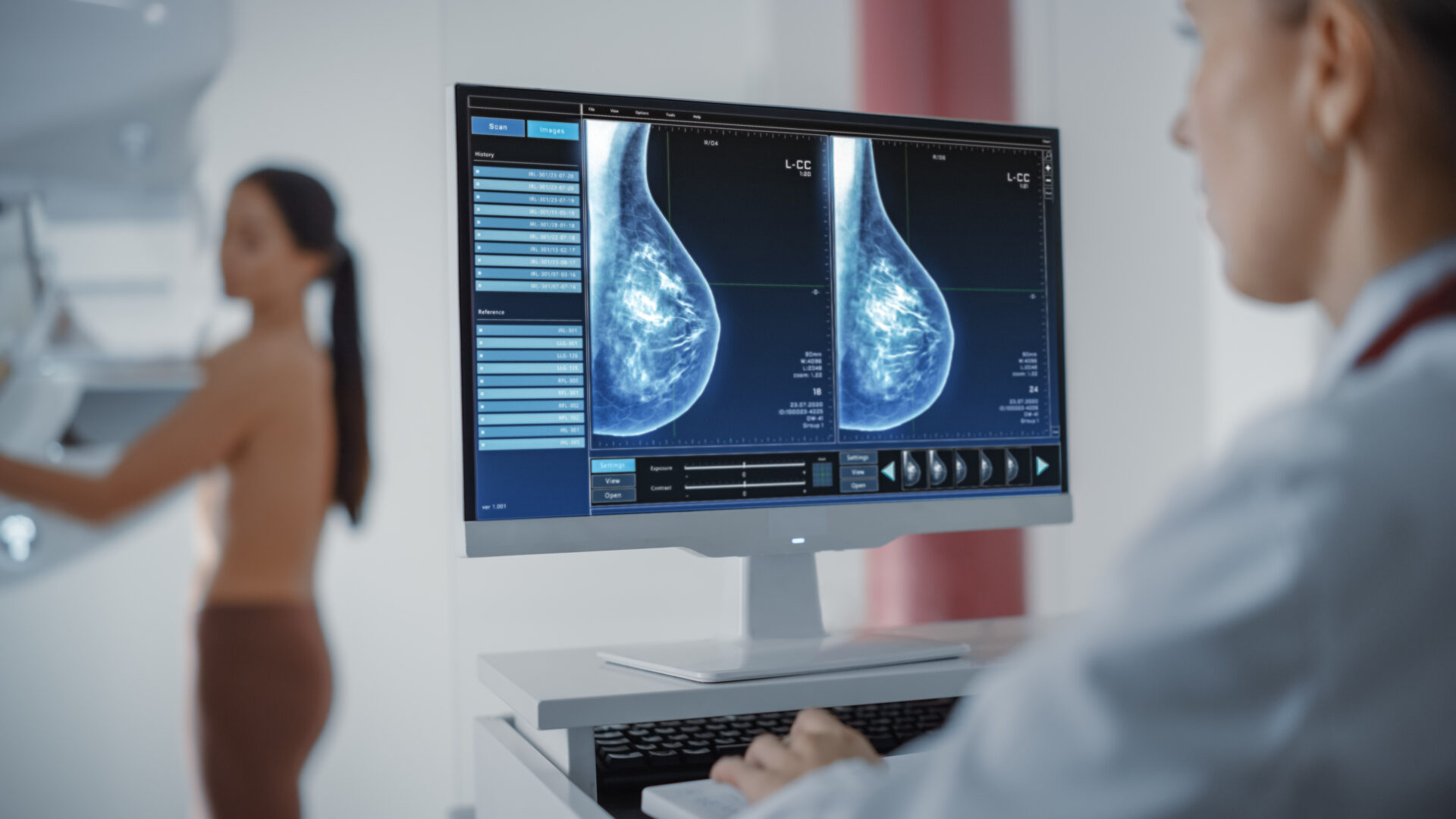 Le dépistage du cancer du sein, un outil essentiel si on souhaite agir rapidement contre la maladie. Adobe Stock