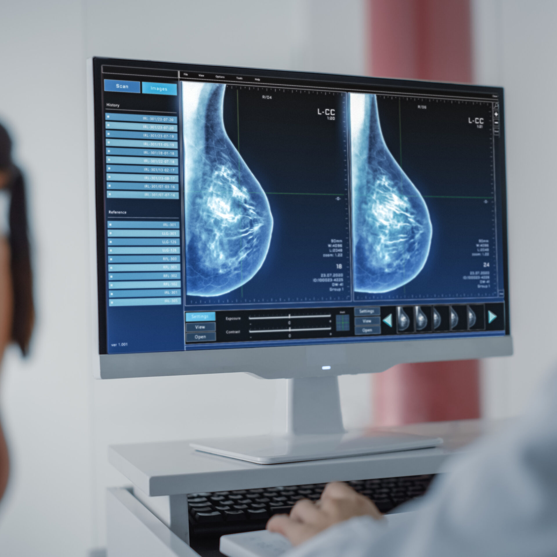 Le dépistage du cancer du sein, un outil essentiel si on souhaite agir rapidement contre la maladie. Adobe Stock